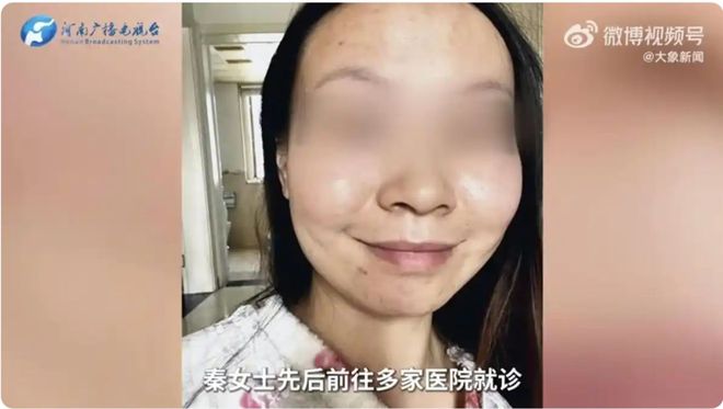 生物：优势渐失至今未拿到Ⅲ类医疗器械批文PG麻将胡了试玩平台“风暴眼”中的巨子(图10)